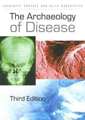 A betegség régészete - The Archaeology of Disease