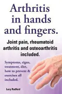 Artritisz a kézben és artritisz az ujjakban. Reumatoid artritisz és osteoartritisz. Tünetek, jelek, kezelés, diéta, megelőzés és edzés. - Arthritis in Hands and Arthritis in Fingers. Rheumatoid Arthritis and Osteoarthritis Included. Symptoms, Signs, Treatment, Diet, How to Prevent & Exer