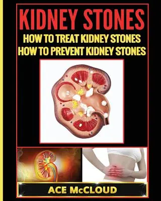 Vesekövek: Vesekő: Hogyan kezeljük a veseköveket: Hogyan lehet megelőzni a veseköveket - Kidney Stones: How To Treat Kidney Stones: How To Prevent Kidney Stones