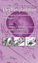 Májtranszplantáció: Kihívó viták és témák - Liver Transplantation: Challenging Controversies and Topics