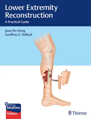 Alsó végtagok rekonstrukciója: A Practical Guide (Gyakorlati útmutató) - Lower Extremity Reconstruction: A Practical Guide