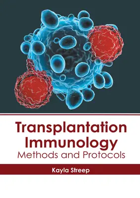 Transzplantációs immunológia: Módszerek és protokollok - Transplantation Immunology: Methods and Protocols