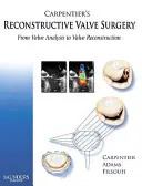 Carpentier's Reconstructive Valve Surgery: A billentyűelemzéstől a billentyűrekonstrukcióig - Carpentier's Reconstructive Valve Surgery: From Valve Analysis to Valve Reconstruction