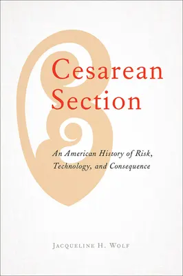 Császármetszés: A kockázat, a technológia és a következmények amerikai története - Cesarean Section: An American History of Risk, Technology, and Consequence