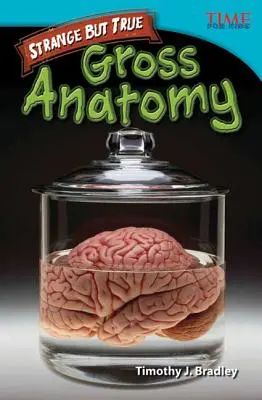 Furcsa, de igaz: Durva anatómia - Strange but True: Gross Anatomy