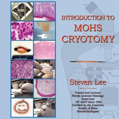 Bevezetés a MOHS kriotómiába - Introduction to MOHS Cryotomy