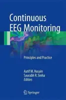 Folyamatos EEG-monitorozás: EEG: Alapelvek és gyakorlat - Continuous Eeg Monitoring: Principles and Practice