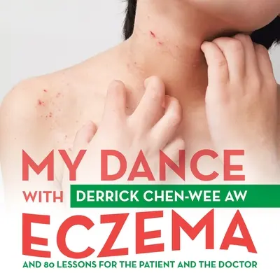 Táncom az ekcémával: És 80 lecke a betegnek és az orvosnak - My Dance with Eczema: And 80 Lessons for the Patient and the Doctor