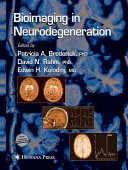 Bioimaging a neurodegenerációban - Bioimaging in Neurodegeneration