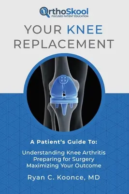 A térdprotézis: A Patient's Guide To: A térdízületi gyulladás megértése, felkészülés a műtétre, a kimenetel maximalizálása - Your Knee Replacement: A Patient's Guide To: Understanding Knee Arthritis, Preparing for Surgery, Maximizing Your Outcome