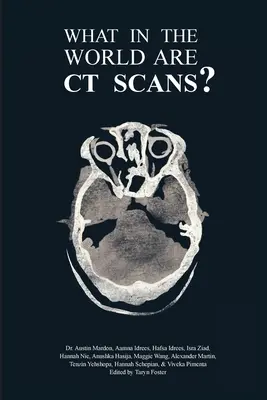 Mi a fene az a CT-vizsgálat? - What in the World are CT Scans?