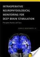 Intraoperatív neurofiziológiai monitorozás a mély agyi stimulációhoz: Alapelvek, gyakorlat és esetek - Intraoperative Neurophysiological Monitoring for Deep Brain Stimulation: Principles, Practice, and Cases