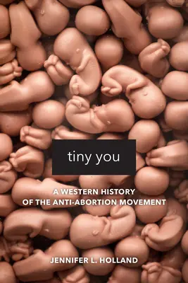 Tiny You: Az abortuszellenes mozgalom nyugati története - Tiny You: A Western History of the Anti-Abortion Movement