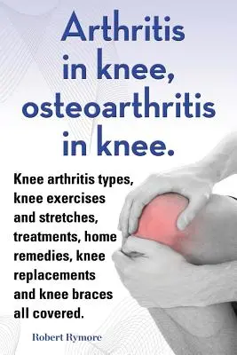 Arthritis a térdben, osteoarthritis a térdben. Térdízületi artritisz típusok, térdgyakorlatok és nyújtások, kezelések, házi gyógymódok, térdprotézisek és térd b - Arthritis in knee, osteoarthritis in knee. Knee arthritis types, knee exercises and stretches, treatments, home remedies, knee replacements and knee b