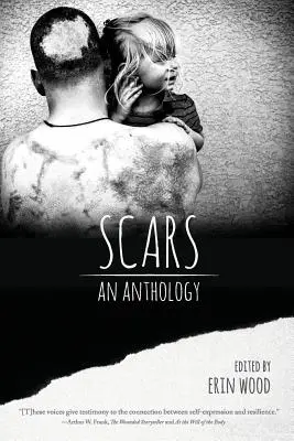 Sebhelyek: An Anthology - Scars: An Anthology