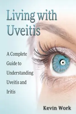 Élet az Uveitisszel: A Complete Guide to Uveitis and Iritis (Teljes útmutató az Uveitis és az Iritis kezeléséhez) - Living with Uveitis: A Complete Guide to Uveitis and Iritis