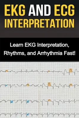 EKG és EKG értelmezés: Tanulja meg gyorsan az EKG-értelmezést, a ritmusokat és az aritmiát! - EKG and ECG Interpretation: Learn EKG Interpretation, Rhythms, and Arrhythmia Fast!