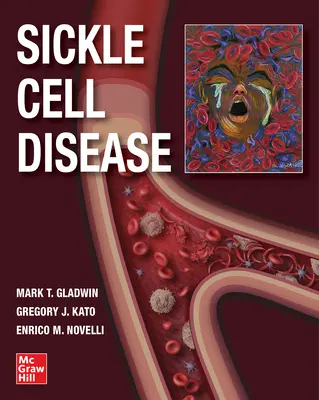 Sarlósejtes betegség - Sickle Cell Disease