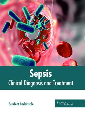 Szepszis: Szepszis: Klinikai diagnózis és kezelés - Sepsis: Clinical Diagnosis and Treatment