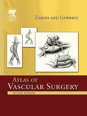 Az érsebészet atlasza - Puhakötéses kiadás - Atlas of Vascular Surgery - Paperback Edition