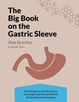 A nagy könyv a gyomorhüvelyről: Minden, amit tudnia kell a fogyáshoz és a jó élethez a függőleges hüvelygasztrektómiával - The Big Book on the Gastric Sleeve: Everything You Need to Know to Lose Weight and Live Well with the Vertical Sleeve Gastrectomy