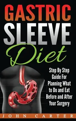 Gyomorszűkítő diéta: Lépésről lépésre útmutató a műtét előtti és utáni teendők és étkezések megtervezéséhez - Gastric Sleeve Diet: Step By Step Guide For Planning What to Do and Eat Before and After Your Surgery