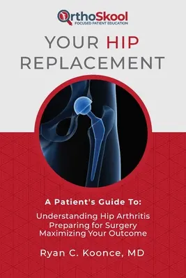 Az Ön csípőprotézise: A Patient's Guide To: A csípőízületi gyulladás megértése, felkészülés a műtétre, a kimenetel maximalizálása - Your Hip Replacement: A Patient's Guide To: Understanding Hip Arthritis, Preparing for Surgery, Maximizing Your Outcome