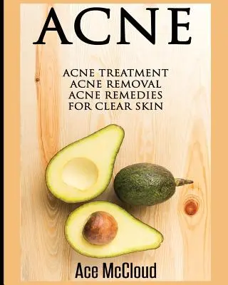 Pattanások: Pattanások kezelése: Akne eltávolítása: A pattanások elleni szerek a tiszta bőrért - Acne: Acne Treatment: Acne Removal: Acne Remedies For Clear Skin