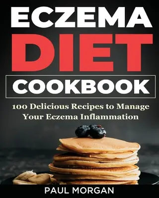 Ekcéma DIet szakácskönyv: 100 finom recept az ekcémás gyulladás kezeléséhez - Eczema DIet Cookbook: 100 Delicious Recipes to Manage your Eczema Inflammation