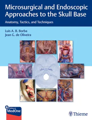 A koponyaalap mikrosebészeti és endoszkópos megközelítései: Taktika és technikák: anatómia, taktika és technikák - Microsurgical and Endoscopic Approaches to the Skull Base: Anatomy, Tactics, and Techniques