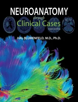 Neuroanatómia klinikai eseteken keresztül - Neuroanatomy Through Clinical Cases