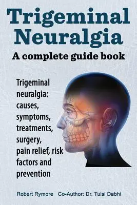 Trigeminalis neuralgia: egy teljes útikönyv. Trigeminalis neuralgia: okok, tünetek, kezelések, műtétek, - Trigeminal neuralgia: a complete guide book. Trigeminal neuralgia: causes, symptoms, treatments, surgery,