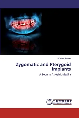 Járomcsont- és pterygoid-implantátumok - Zygomatic and Pterygoid Implants