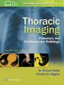 Mellkasi képalkotás: Tüdő- és szív- és érrendszeri radiológia - Thoracic Imaging: Pulmonary and Cardiovascular Radiology