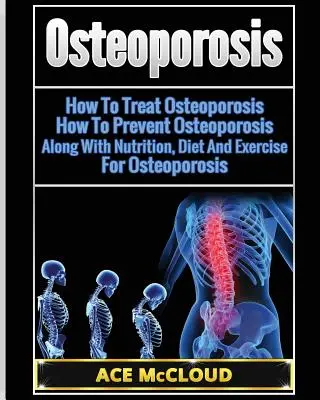 Csontritkulás: Hogyan kezeljük a csontritkulást: Hogyan előzzük meg a csontritkulást: Táplálkozással, diétával és testmozgással együtt a csontritkulás ellen. - Osteoporosis: How To Treat Osteoporosis: How To Prevent Osteoporosis: Along With Nutrition, Diet And Exercise For Osteoporosis