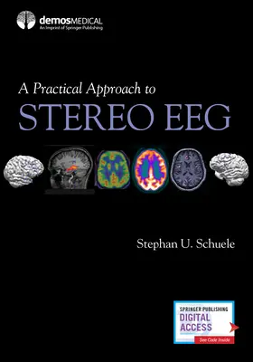 A sztereó Eeg gyakorlati megközelítése - A Practical Approach to Stereo Eeg