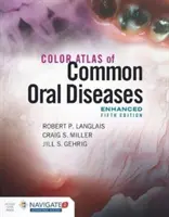 A gyakori szájbetegségek színes atlasza, bővített kiadás - Color Atlas of Common Oral Diseases, Enhanced Edition