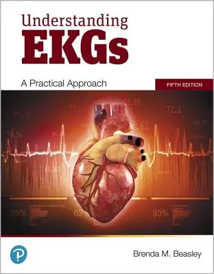 EKG-k megértése: gyakorlati megközelítés - Understanding EKGs: A Practical Approach