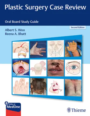 Plasztikai sebészeti esetek áttekintése: Szájsebészet: Orális Board Study Guide: Oral Board Study Guide - Plastic Surgery Case Review: Oral Board Study Guide