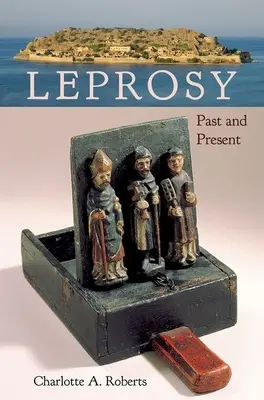 Lepra: múlt és jelen - Leprosy: Past and Present