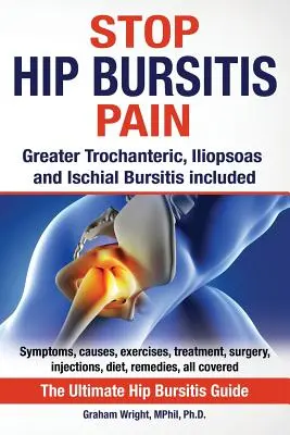 Stop Hip Bursitis fájdalom: Nagyobb trochanteric, Iliopsoas és Ischialis Bursitis - Stop Hip Bursitis Pain: Greater Trochanteric, Iliopsoas and Ischial Bursitis