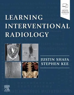 Learning Interventional Radiology (Intervenciós radiológia tanulása) - Learning Interventional Radiology