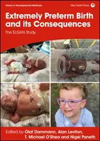 Rendkívül koraszülés és következményei: Az Elgan-tanulmány - Extremely Preterm Birth and Its Consequences: The Elgan Study