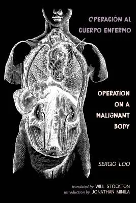 Operacin al Cuerpo Enfermo / Műtét egy rosszindulatú testen - Operacin al Cuerpo Enfermo / Operation on a Malignant Body