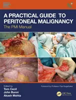 Gyakorlati útmutató a peritoneális malignitáshoz: A PMI kézikönyv - A Practical Guide to Peritoneal Malignancy: The PMI Manual