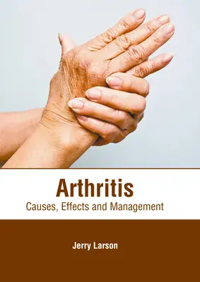 Arthritis: Okok, hatások és kezelés - Arthritis: Causes, Effects and Management