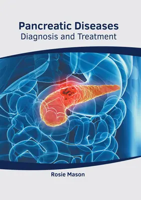 Hasnyálmirigy-betegségek: Diagnózis és kezelés - Pancreatic Diseases: Diagnosis and Treatment