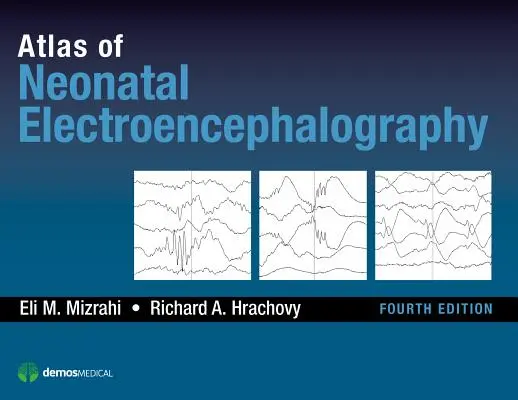 Az újszülöttkori elektroenkefalográfia atlasza - Atlas of Neonatal Electroencephalography