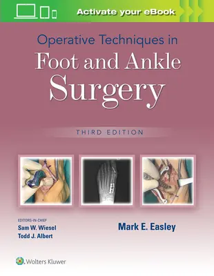 Operatív technikák a láb- és bokaműtétben - Operative Techniques in Foot and Ankle Surgery