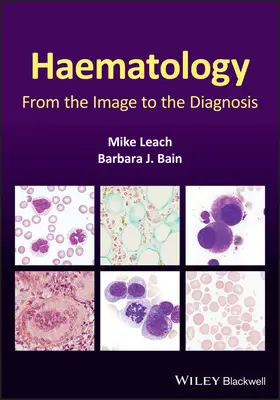 Hematológia: A képtől a diagnózisig - Haematology: From the Image to the Diagnosis